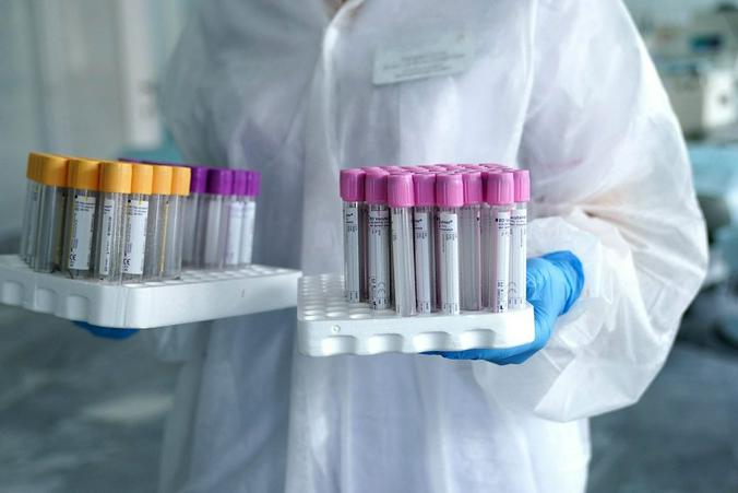 Тестирование на COVID-19: москвичам рассказали о необходимости сдать анализ на антитела 